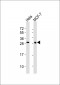 Galectin 3 Antibody